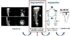Image analysis pipeline: segmentation and registration of implant and bone